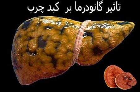 قارچ گانودرما برای کبد چرب