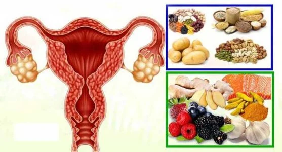 رژیم غذایی بهترین رژیم غذایی برای تنبلی تخمدان