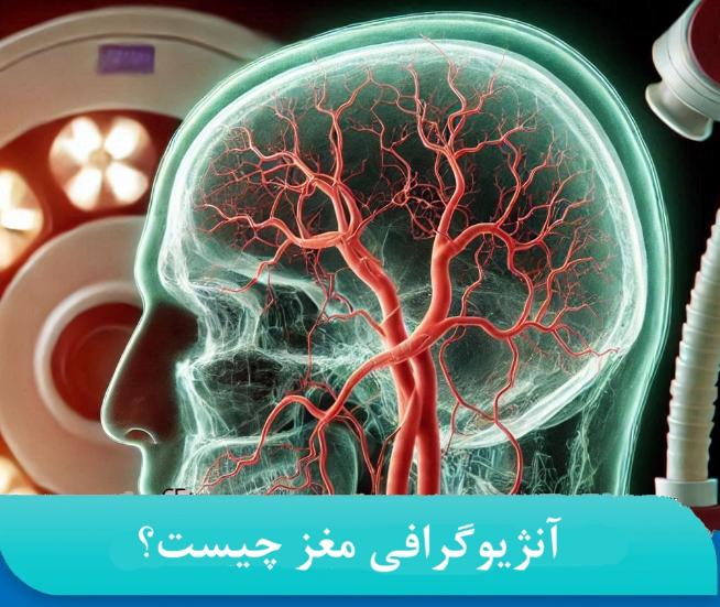 چه بیمارانی نیازمند آنژیوگرافی مغزی هستند؟