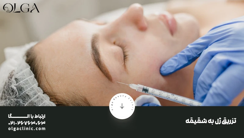 زیبایی | تزریق ژل تزریق ژل به شقیقه